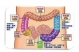 “胖”是肠癌的高危因素！