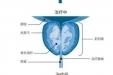 超微创！5分钟解决92岁老人前列腺增生！我院成功开展热蒸汽消融技术