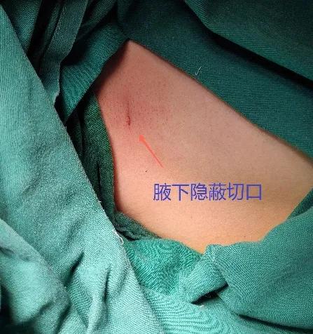 图片 14