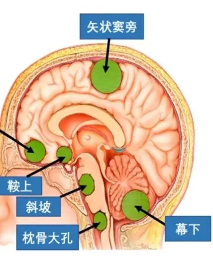 图片 7