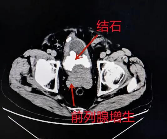 图片 4