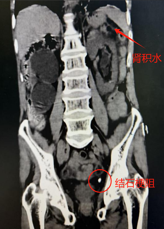 图片 4