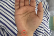 得了“鼠标手”怎么办？试试这一招