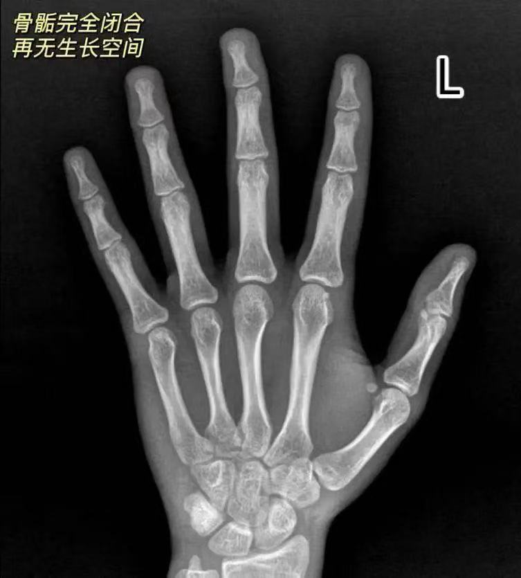 图片 2