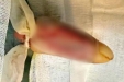 不放弃！我院援非医生成功“保住”非洲矿工手指