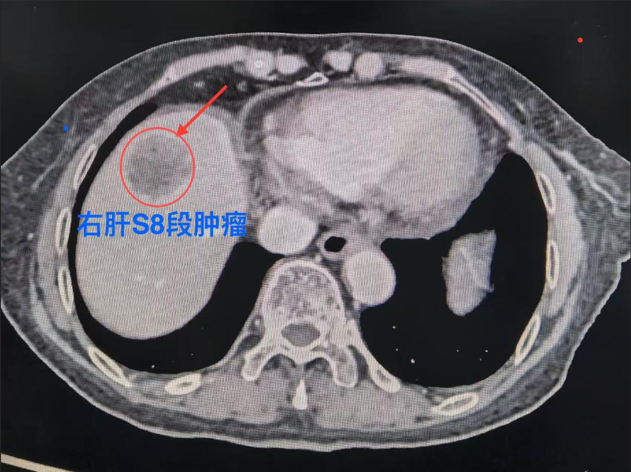 5c4ee36f_ee16_4270_b3d5_c2b044e71279